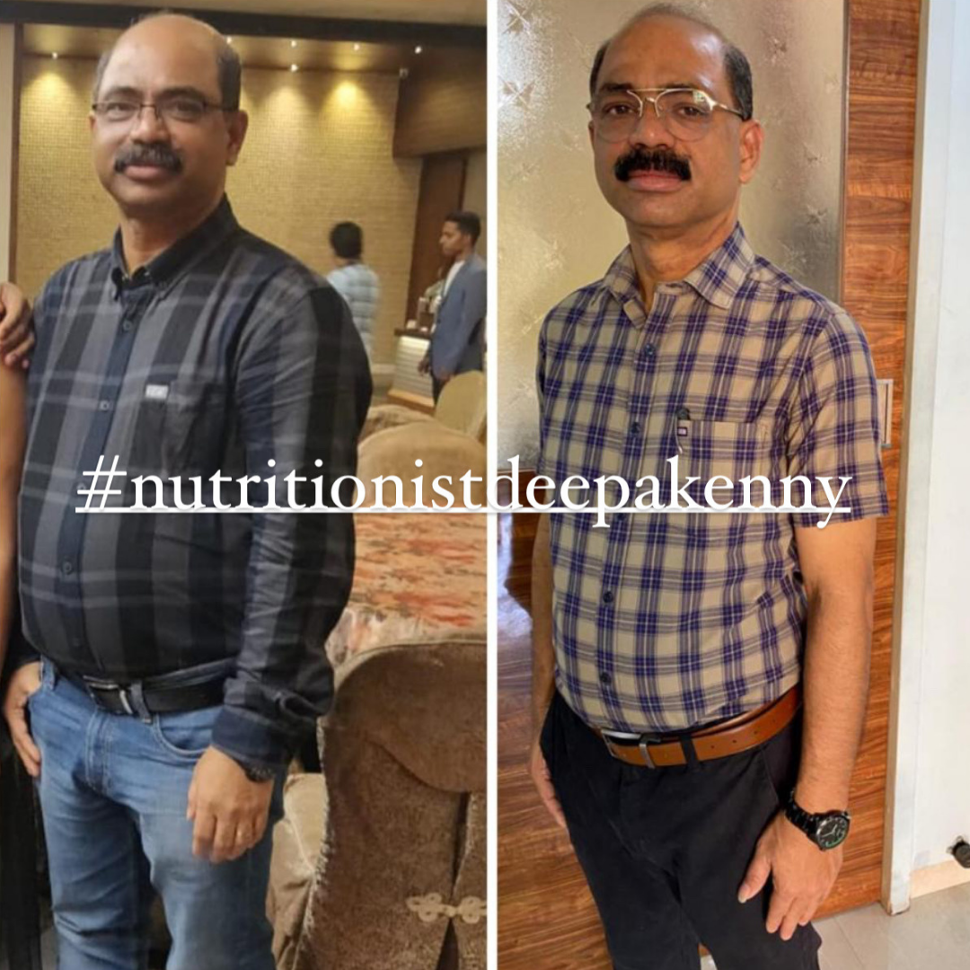 before-after Deepa Kenny Diabetes prevention