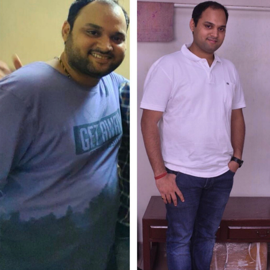 before-after-weight loss dietician