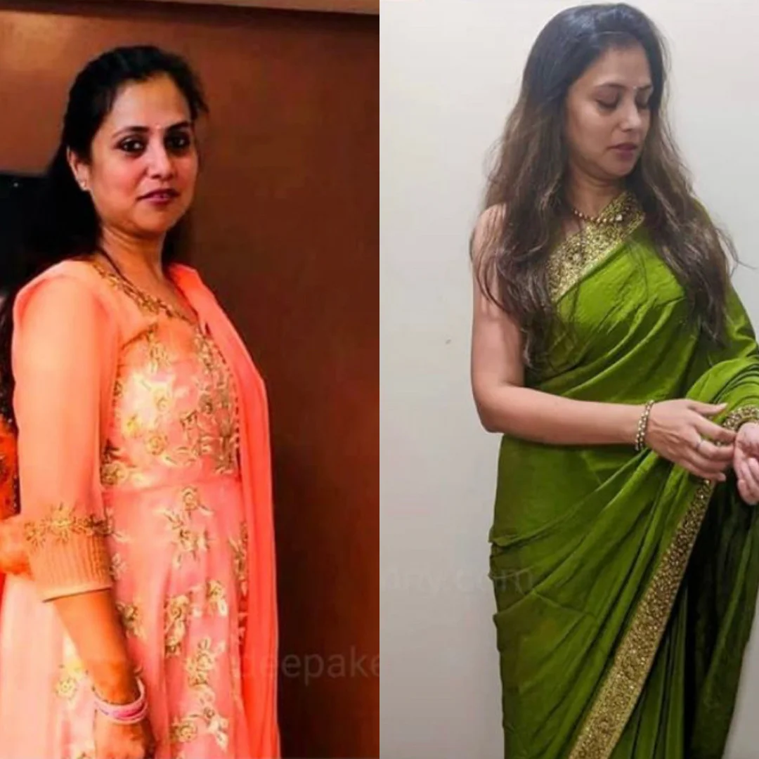 before-after Deepa Kenny Inch Loss Package in Mumbai