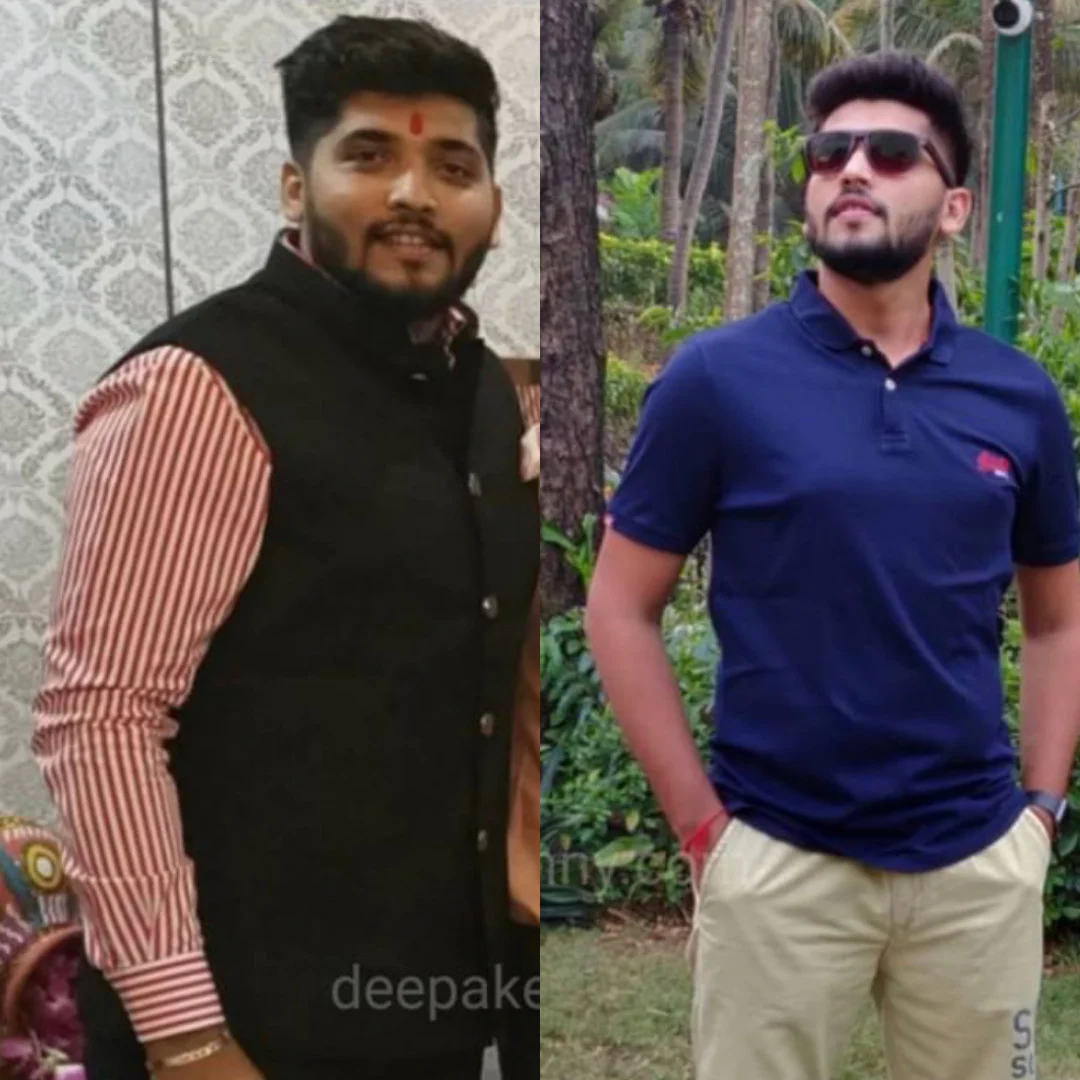 before-after Deepa Kenny Inch Loss Package in India